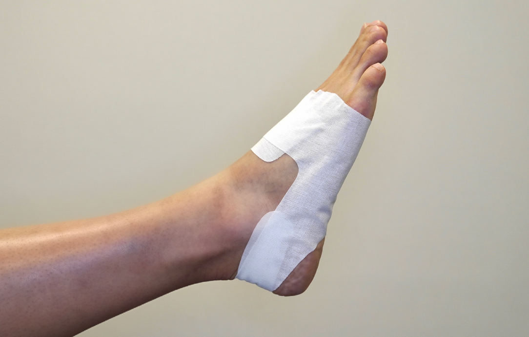 まるでいんそーるテープ